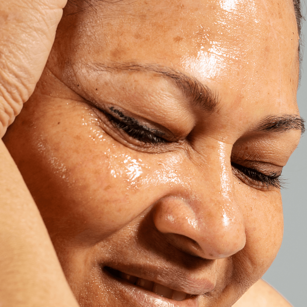 Excès de Sébum : Comment Réguler Naturellement avec votre Chantilly Éclat et l’Huile de Jojoba ? - SIYIRI