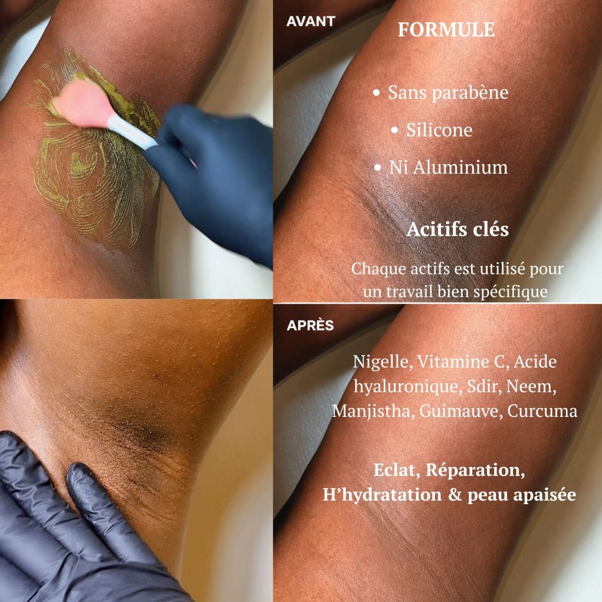 Gamme Aisselles & Visage Naturelle - Peau Nette & Uniforme / SIYIRI - SIYIRI